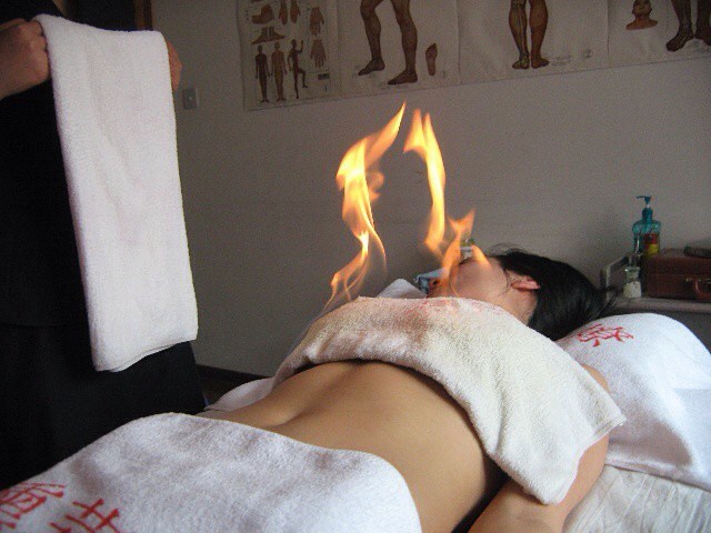 1. Огнен масаж