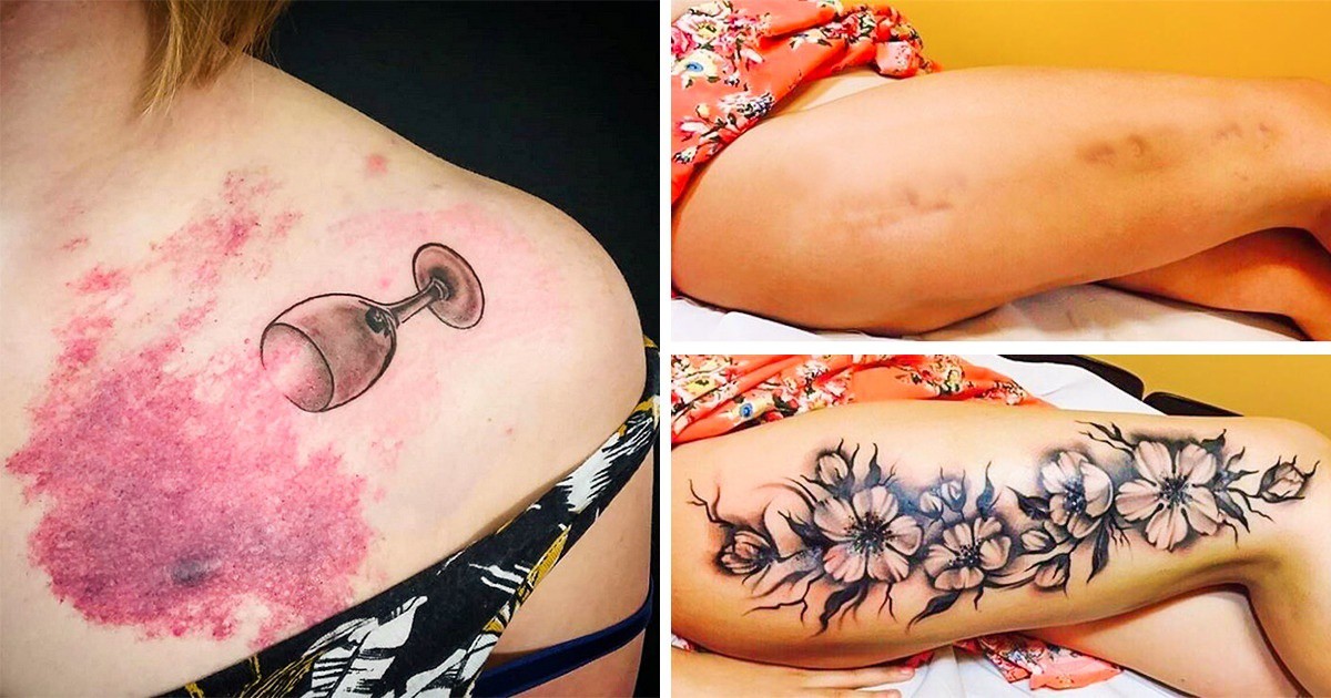 Красота: 27 татуировки, които превръщат белезите в истински шедьоври