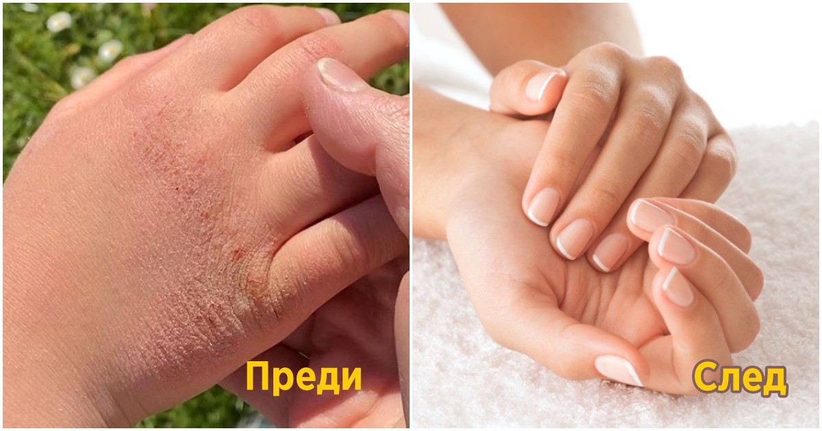 5 лесни начина да се погрижим за кожата на ръцете си