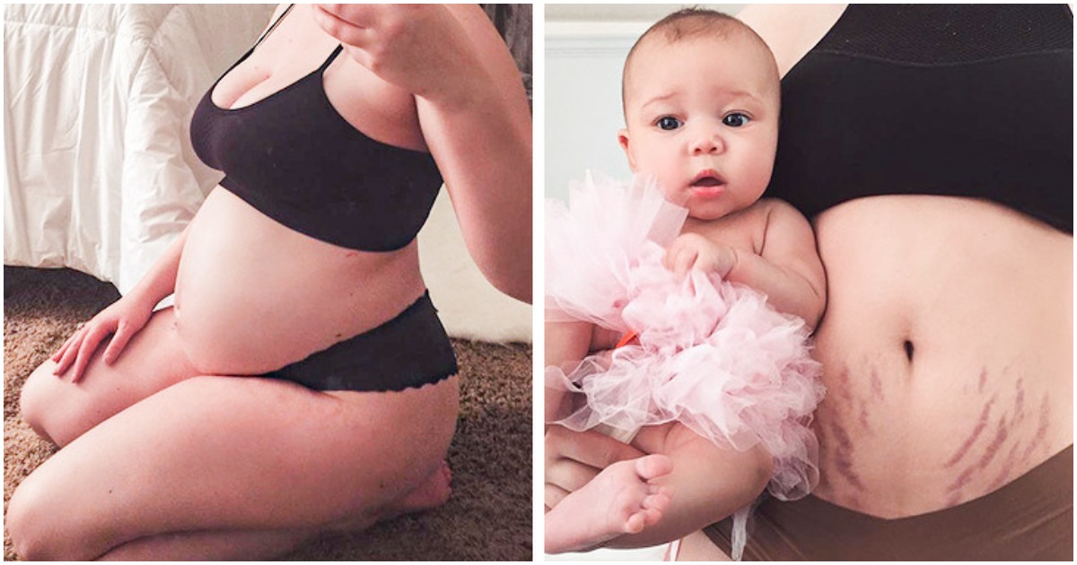 15 снимки преди и след бременността, които показват чудото на раждането
