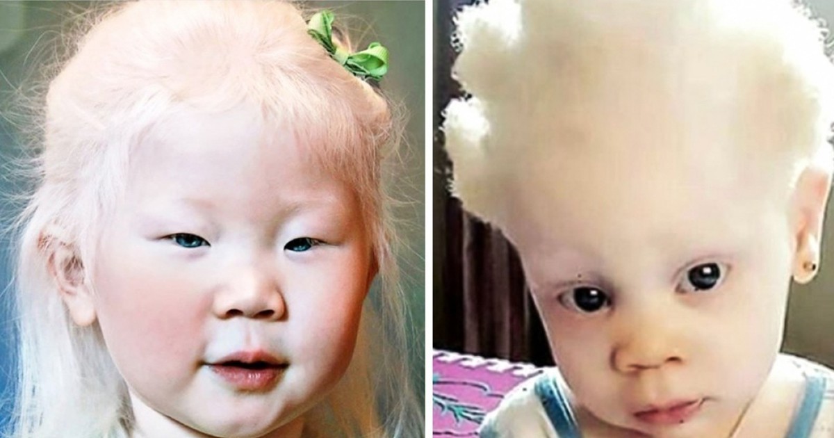Снежна красота: Ето как изглеждат албиносите от различни раси
