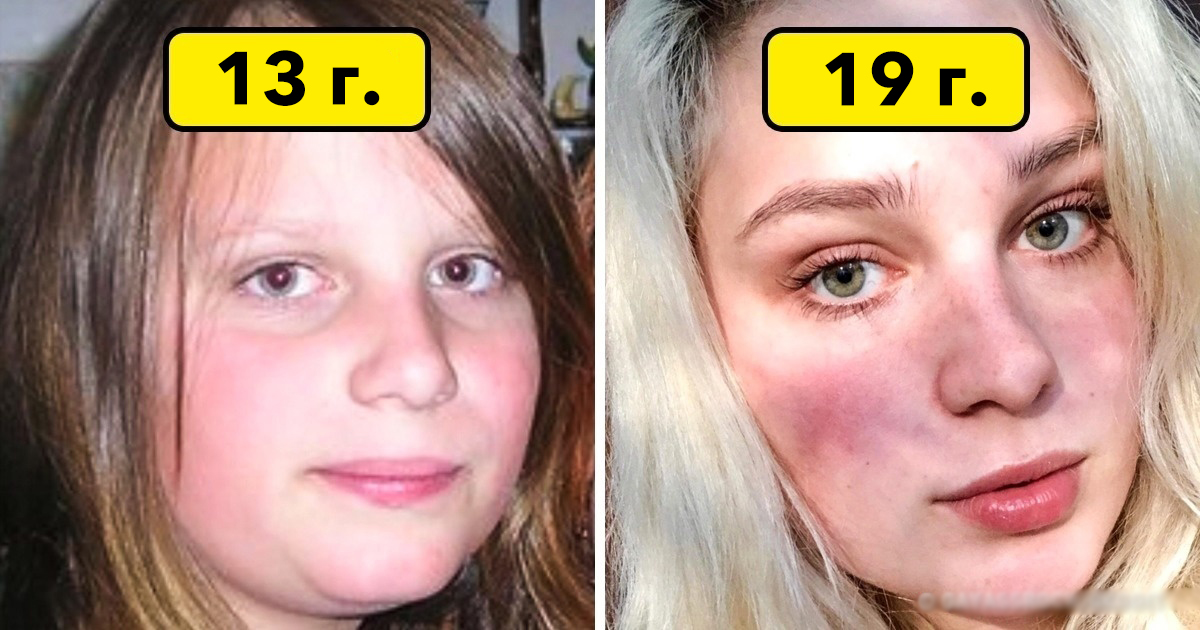 Преди и след: 14 примера, че всеки се променя след пубертета