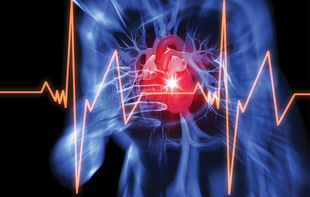 45% от случаите на инфаркт протичат без симптоми. Ето какво трябва да знаете