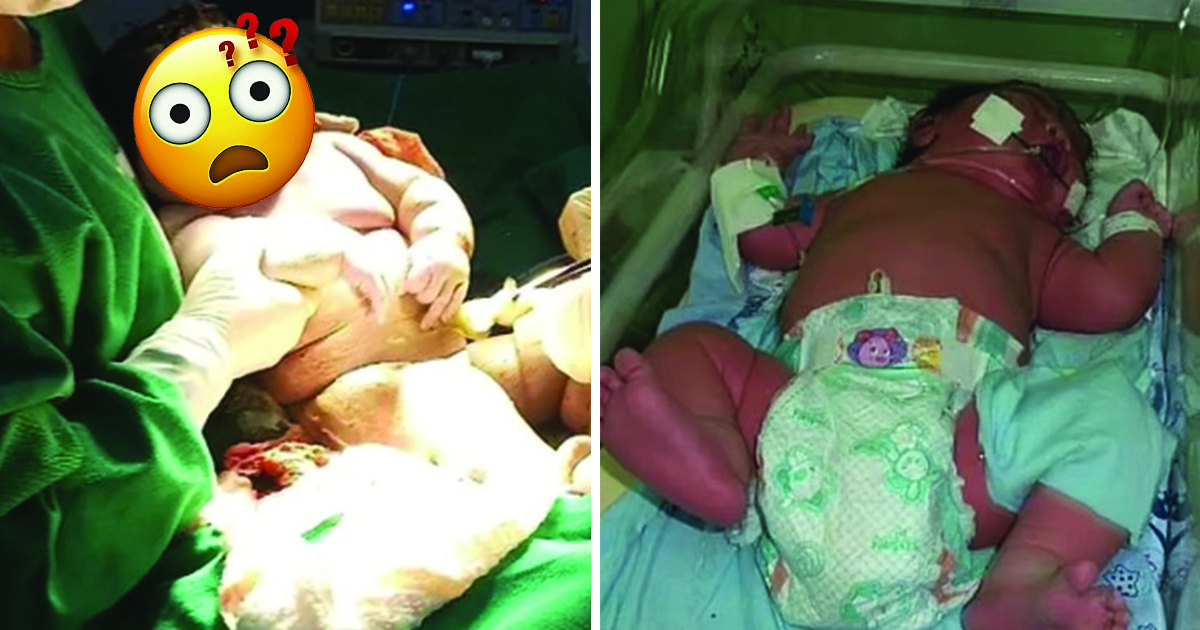 Невероятно, но факт: Бразилка роди 7,3 кг бебе, което носи дрешки за 9-месечно детенце