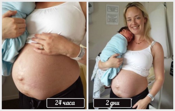 Женското тяло след раждането: Очаквания срещу реалност