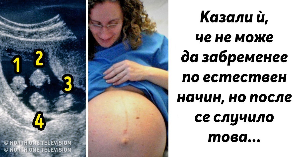 Чудото на живота: Жена забременя с четиризнаци точно преди да се подложи на инвитро