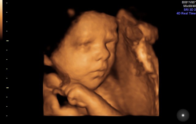 3D или 4D филм на… вашето бебе през бременността
