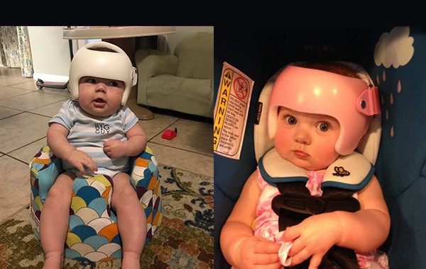 Това бебе е трябвало да носи каска: Eто как реагира семейството му