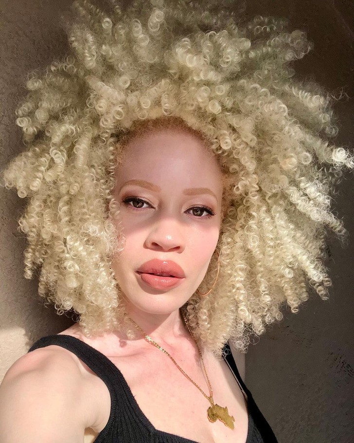 Ефектът да си албинос