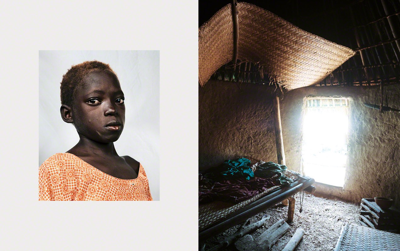 Сайра, 8 г., Сенегал