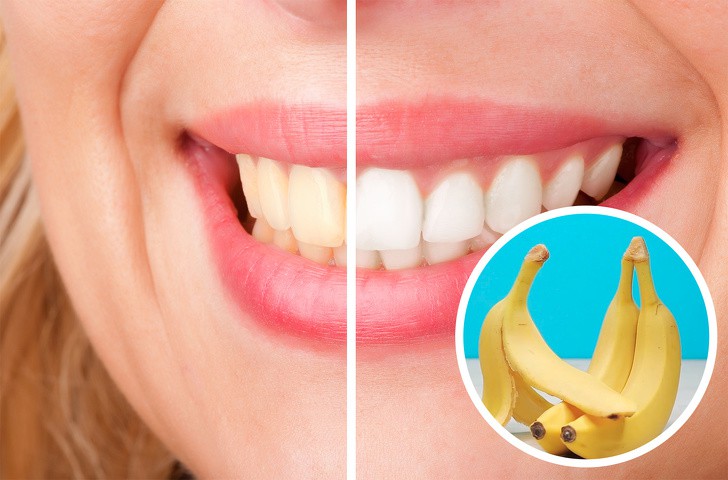 8. Жълти зъби