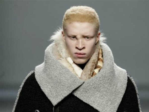 Шон Рос - моделът-албинос