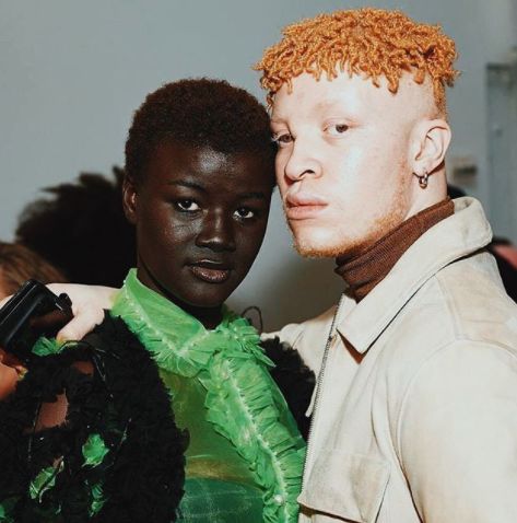 Модел албинос с най-тъмнокожия модел