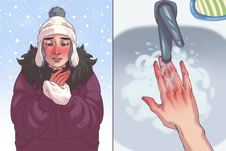 Не търкайте замръзналите си ръце