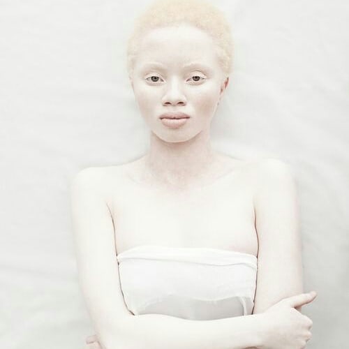 Снежната красота на албиносите