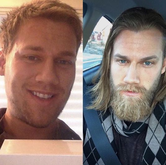 Една брада разлика
