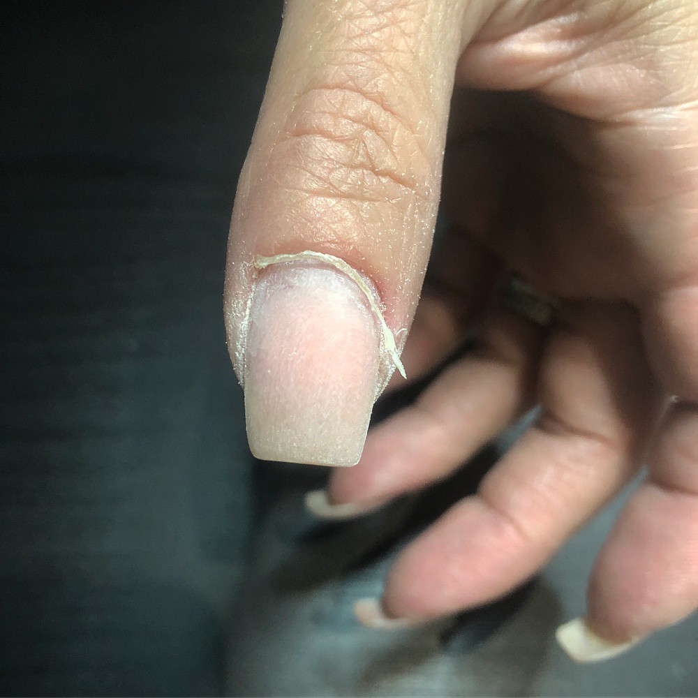 Пропилы на ногтях после аппаратного маникюра. Перепиленные ногти после аппаратного маникюра.