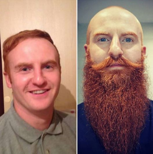 Една брада разлика