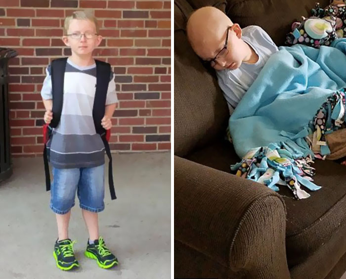 10-годишно момче, което се бори с рака