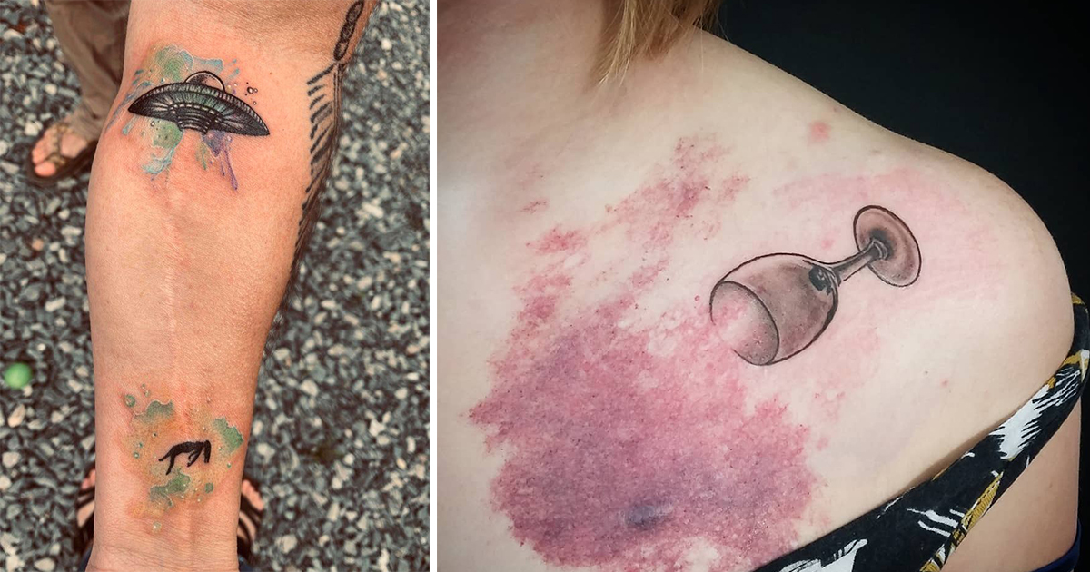 Красиво: 21 татуировки, които доказват, че белезите са красиви