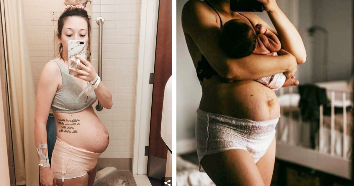 Красива, но и много трудна: Истината за бременността и раждането в 21 фотографии