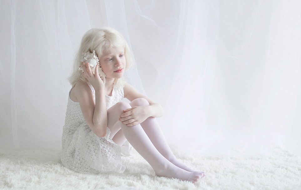 50 нюанса бяло: Красивите тонове на албиносите