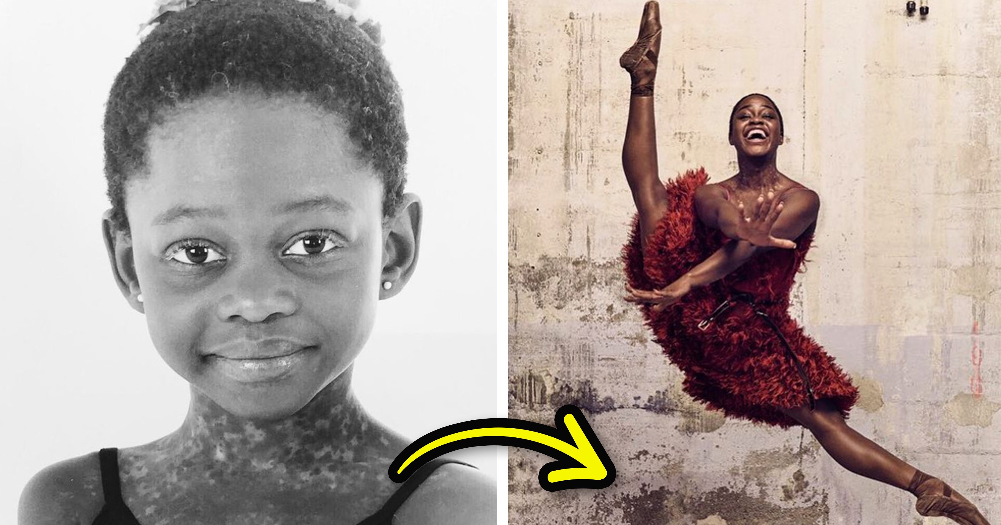 Микаела Депринс е световноизвестна балерина която е била част от