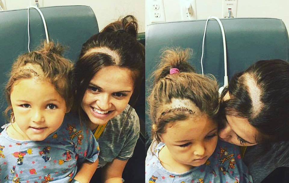 Майка обръсна главата си, за да подкрепи дъщеря си след мозъчна операция