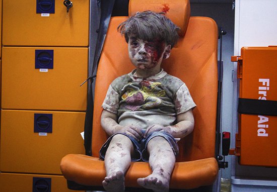 Ангелите на Сирия: Как изглежда днес момченцето, което показа истинското лице на войната