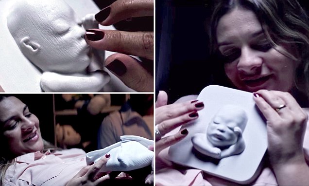 Сляпа майка успя да види нероденото си дете за първи път