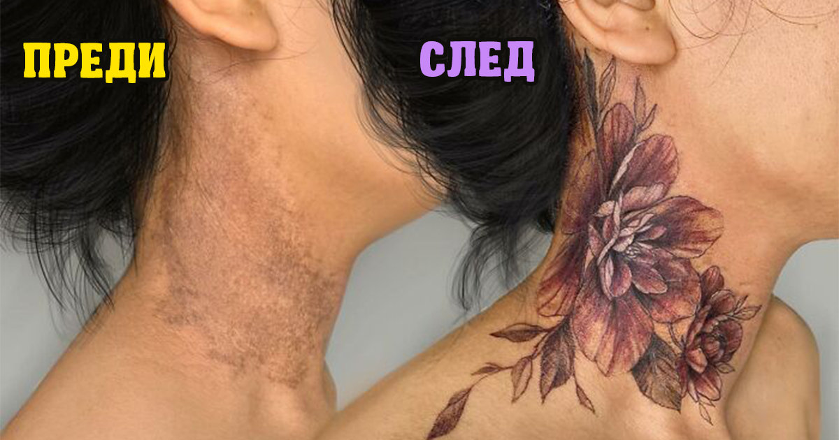 30 татуировки, превърнали белезите в красиво изкуство