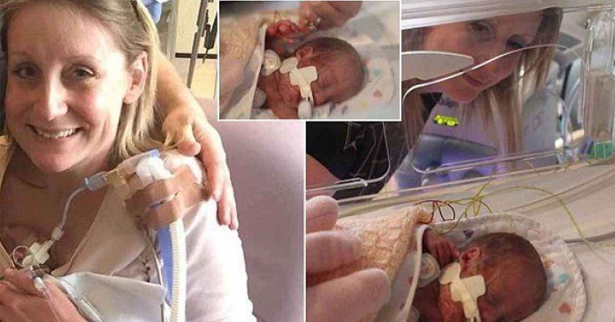 Истинско чудо: Бебе се роди живо и здраво две седмици след като близначето му се роди мъртво