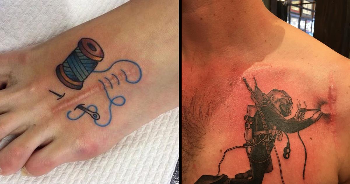 Прекрасни: 18 татуировки, които превръщат белезите в изкуство