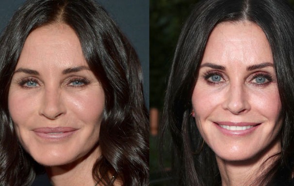 Кортни Кокс преди и сега: Актрисата махна всички филъри от лицето си