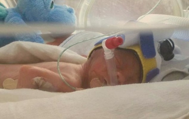 Mалко чудо: Лекари спасиха бебе, родено в 25-тата седмица