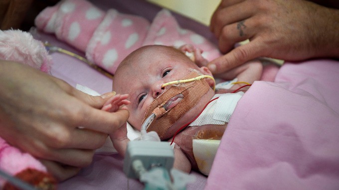 Медицинско чудо: Спасиха бебе, родено със сърце извън гръдния кош