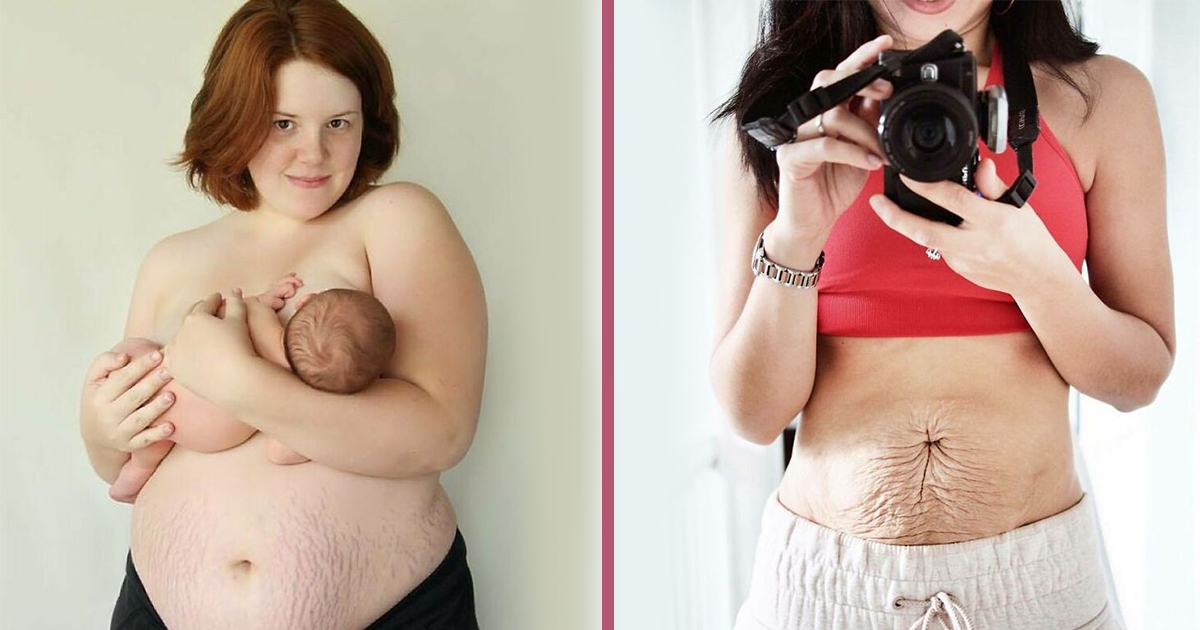 Чудото на живота: 27 майки споделят как изглеждат телата им след раждане