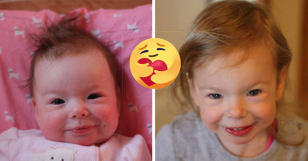 Снимка: Невероятно: Усмивката на бебе се оказва симптом на нелечимо заболяване