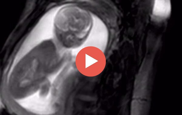 Нов скенер показва как се движат децата в утробата още в 20-тата седмица