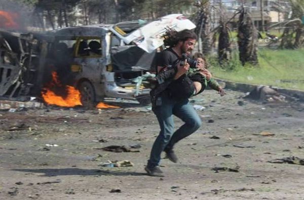 Неописуемо: Сирийски фотограф захвърля камерата, за да помогне на ранено от експлозия момче