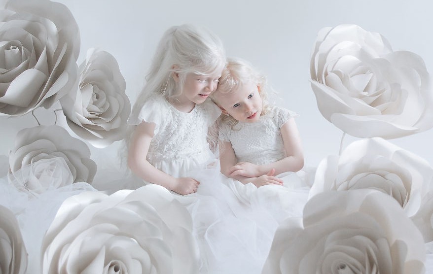Порцеланова красота: Очарованието на албиносите