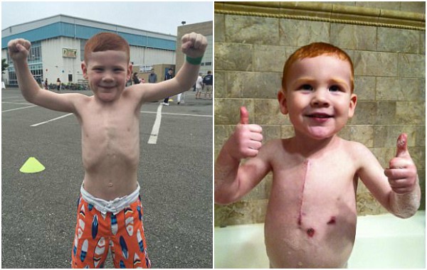 Невероятно: 6-годишно момче, родено с половин сърце, взе участие в триатлон