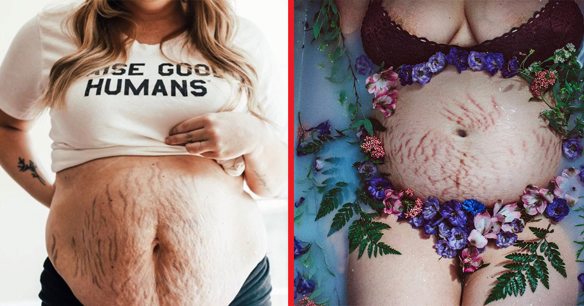 Вдъхновяващо: 18 жени показват как изглеждат телата им след бременност