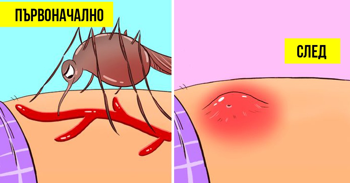 Какво се случва с тялото ни, когато ни ухапе комар