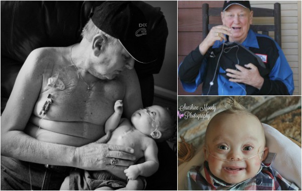 Снимка на дядо и внук с еднакви белези от операции трогна Интернет