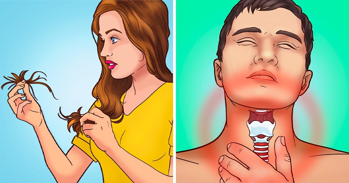 10 признака, че тялото ви отчаяно се нуждае от йод