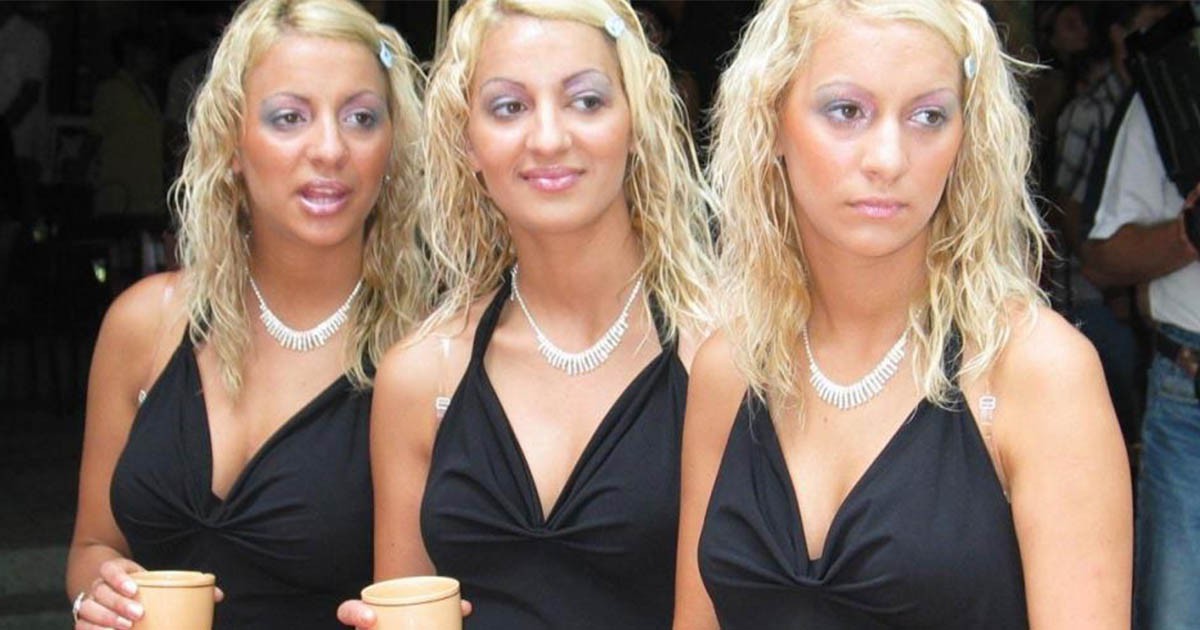 Тризначката Любов се оперира, за да не прилича на сестрите си (СНИМКИ)