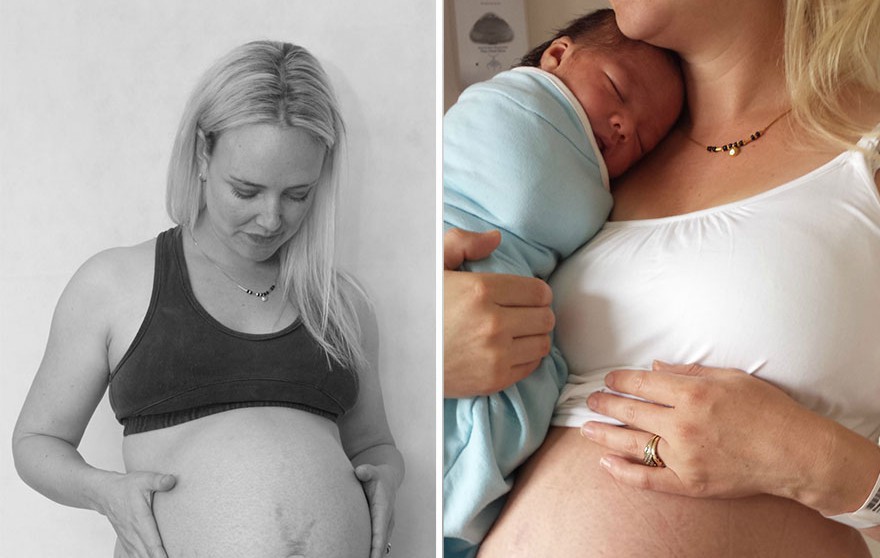 Ето как се променя тялото на една жена непосредствено след раждането