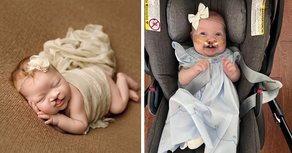 Това бебе със заешка устна умили света, а родителите ѝ споделиха невероятната история зад нея