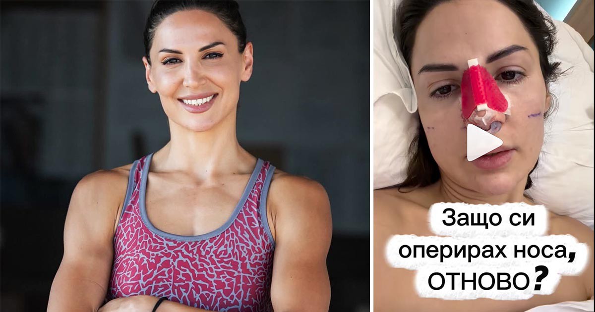 Лекар прецака носа на звезда от „Игри на волята“ (СНИМКИ) width=